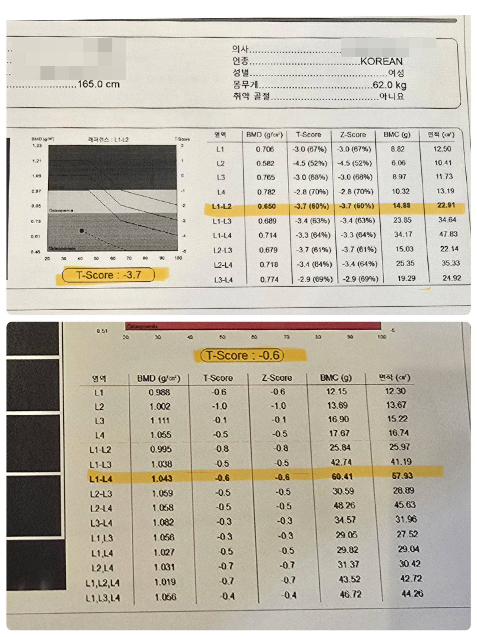 회원이 제공한 골밀도 검사 비교 기록