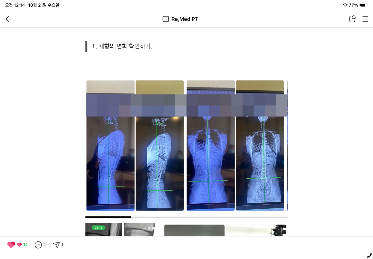체형 비교 자료 · 정면과 측면 기록
