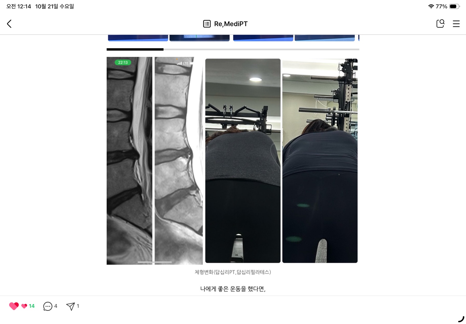 체형 비교 자료 · 첨부 영상자료 및 자세 사진