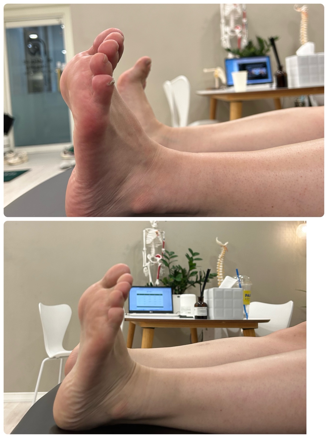 발목 움직임 비교