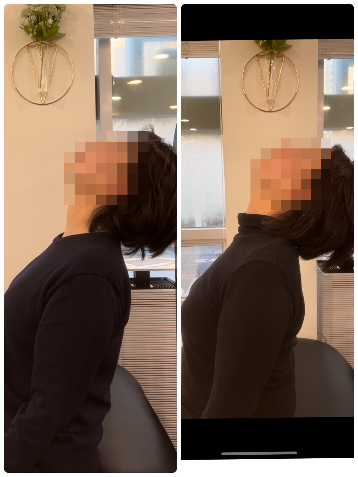목을 뒤로 젖히는 동작 비교