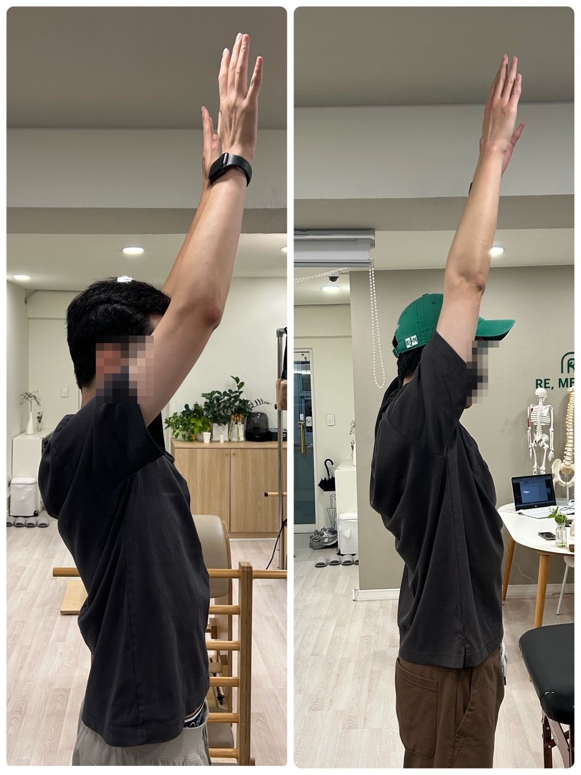 팔을 위로 올리는 동작 비교 기록