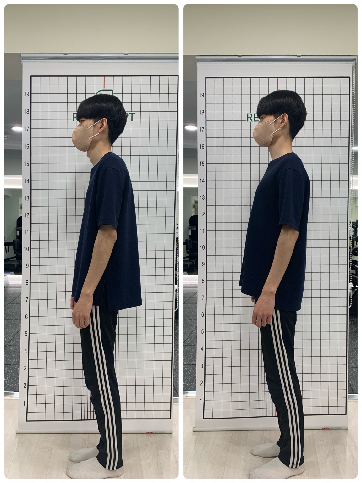 목과 어깨의 측면 자세 비교